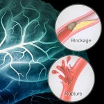 Atherosclerosis Symptoms