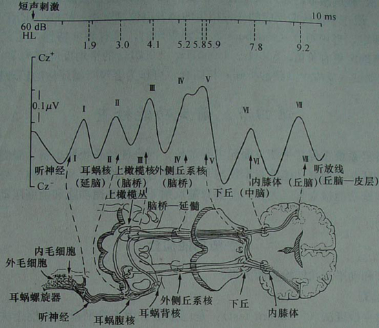 大脑听觉传导神经通路-厦门益耳助听器中心