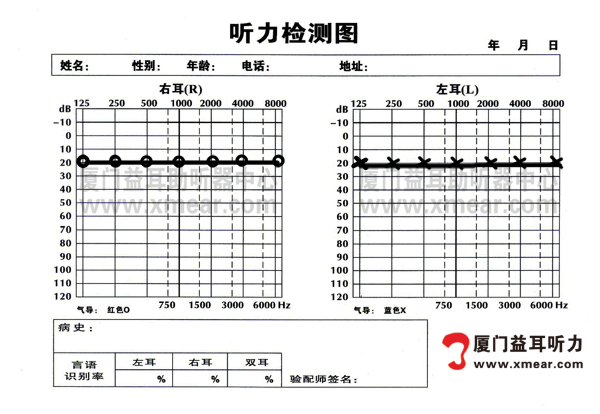 电测听标准正常图图片