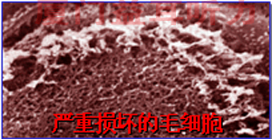 受重受损的毛细胞