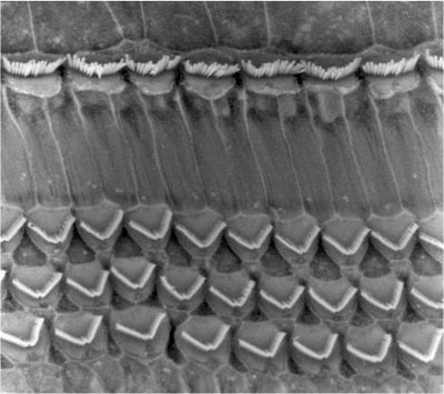 内耳毛细胞—厦门益耳助听器