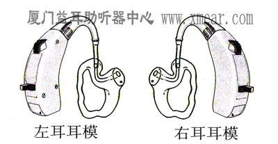 耳模图例—厦门益耳助听器中心