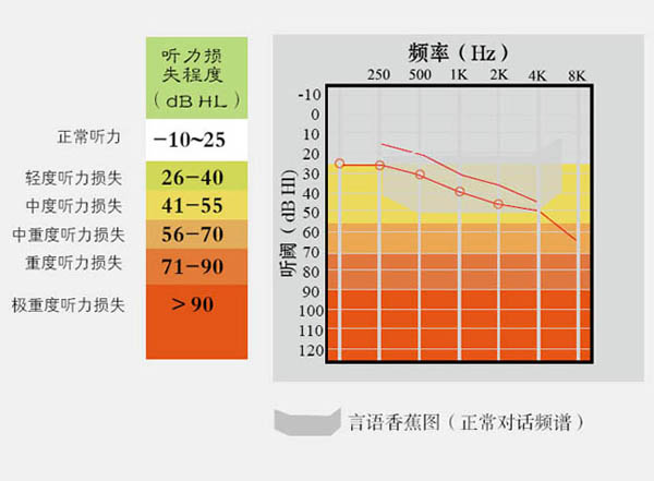 听力损失程度