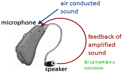 助听器啸叫 助听器反馈