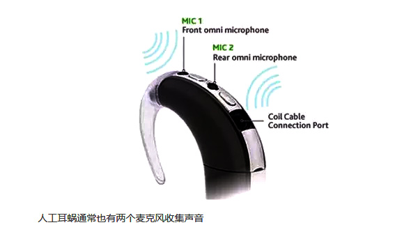 人工耳蜗的麦克风